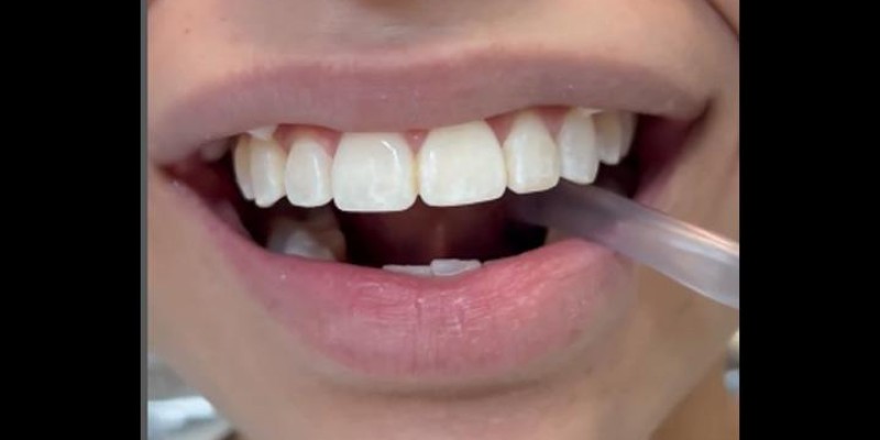 Aparelho Odontológico 