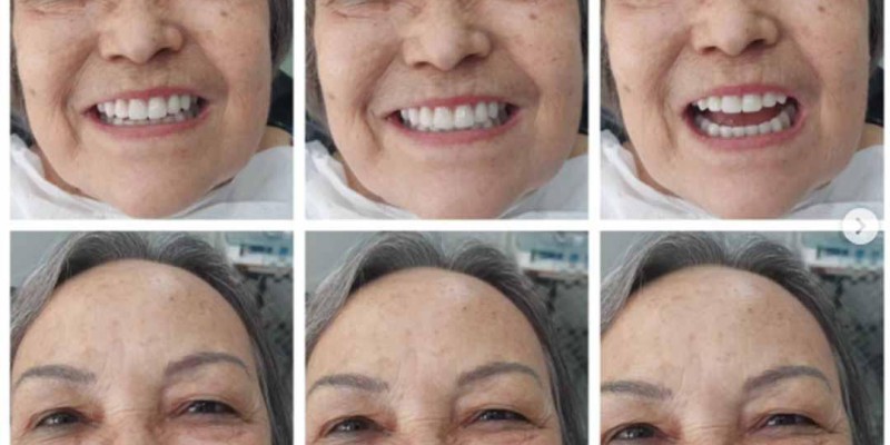 Tratamento Implante Detário