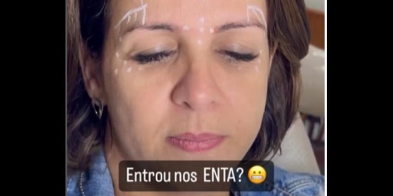 Harmonizacao Facial