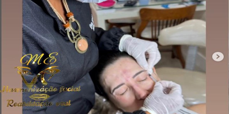 realce sua beleza com o tratamento de botox