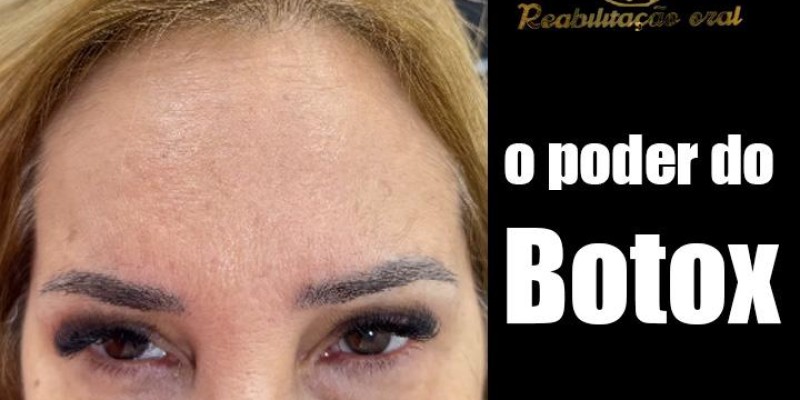 Tratamento de Botox