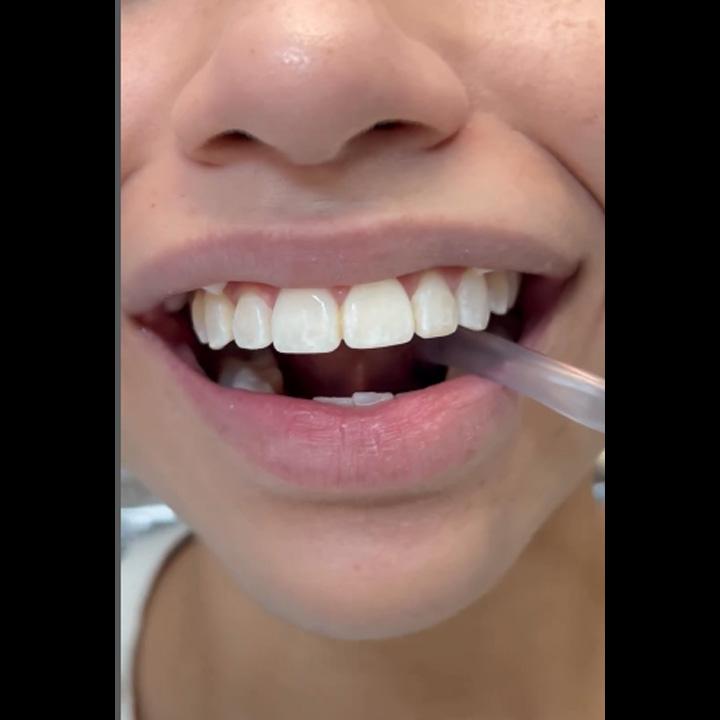 Aparelho Odontológico 